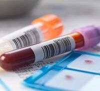 Diagnosis of prostatitis in a laboratory